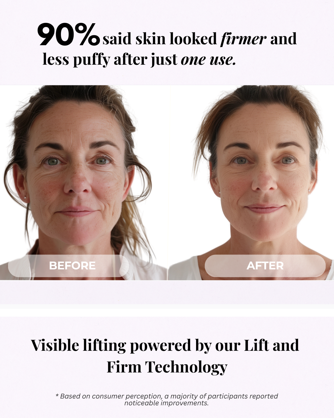 So Vein Diminishing Serum