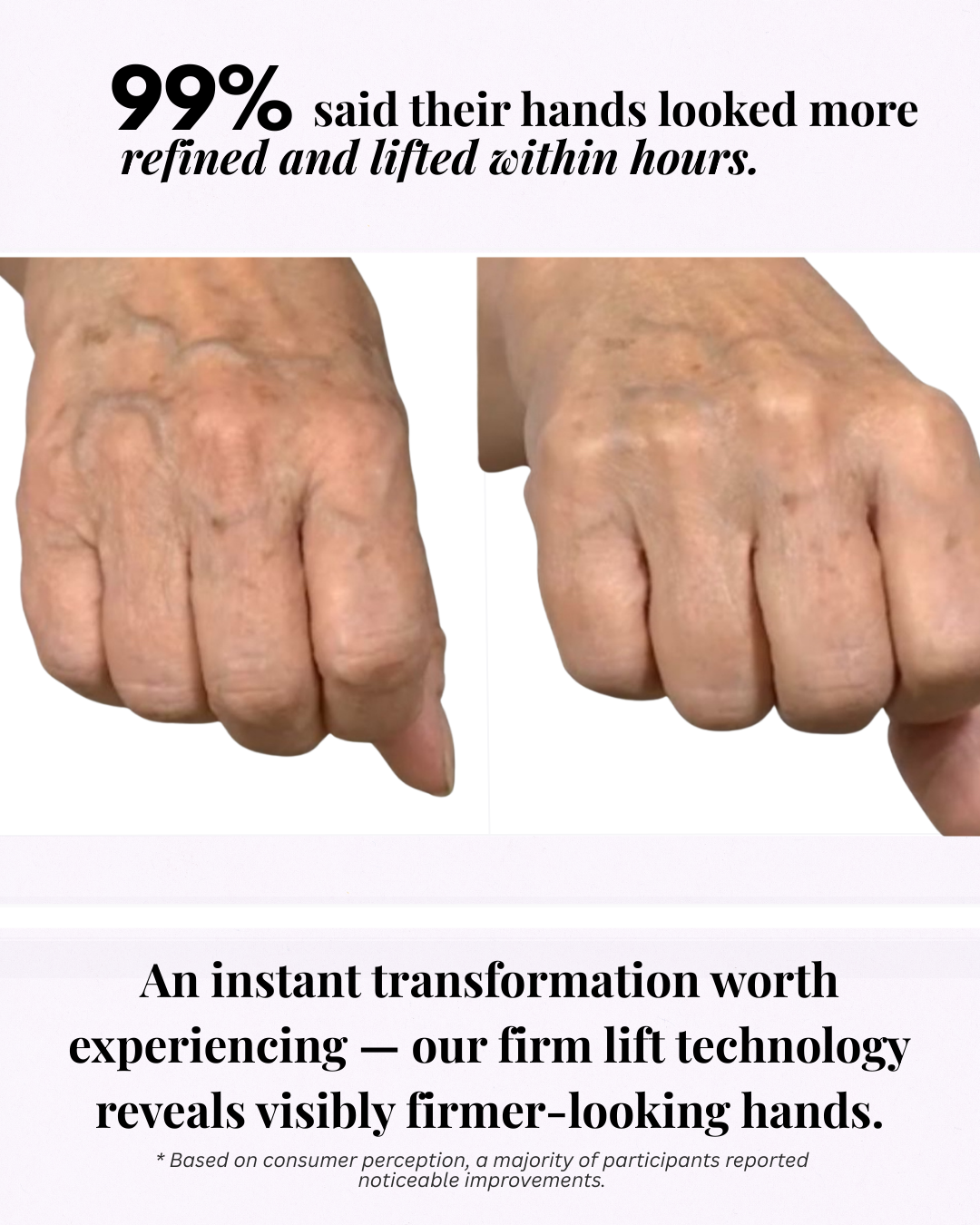 So Vein Diminishing Serum