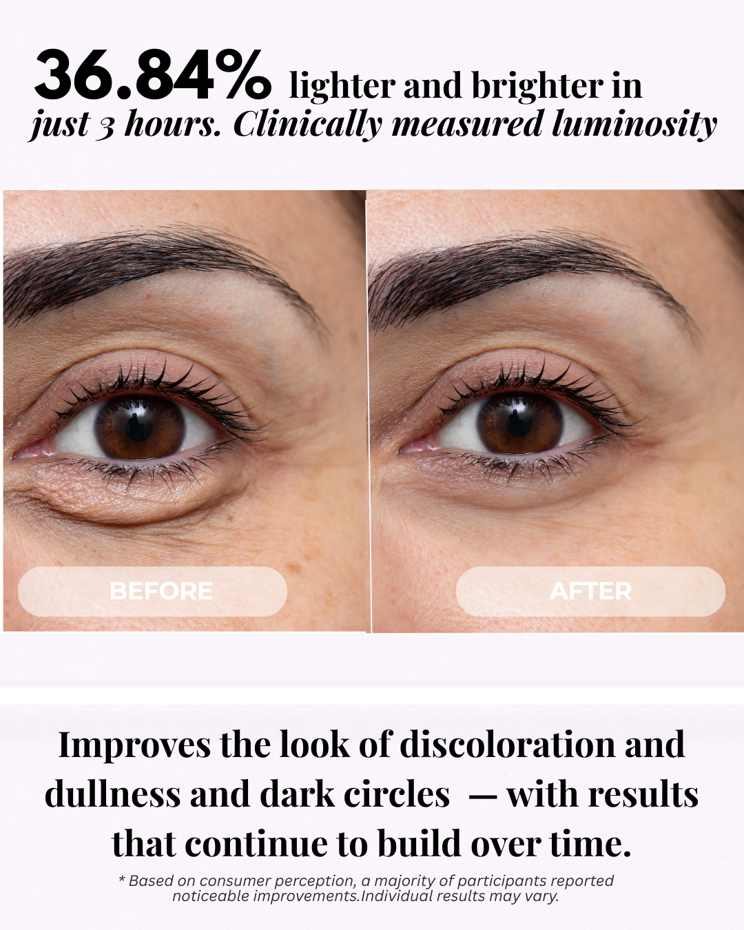 So Vein Diminishing Serum
