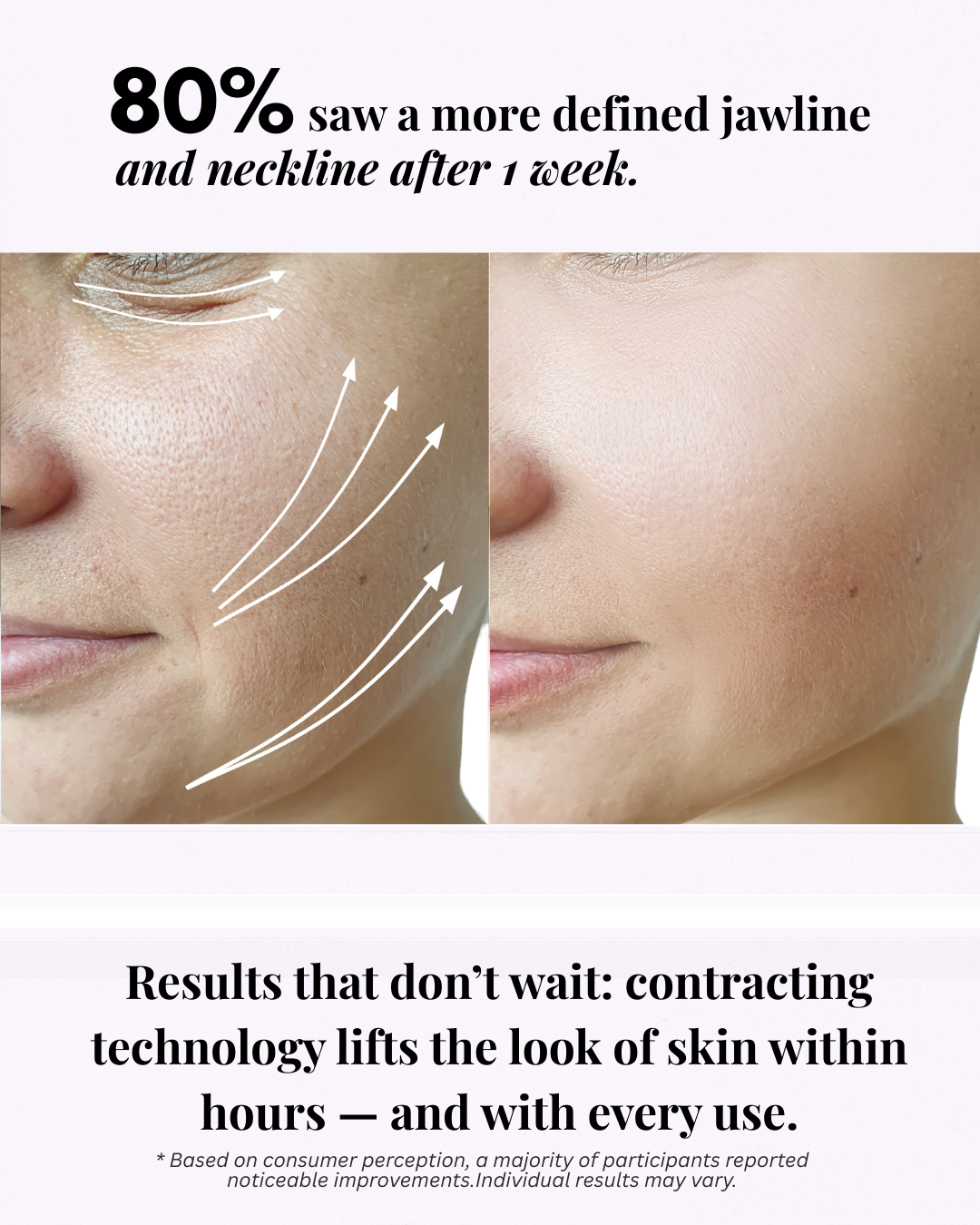 So Vein Diminishing Serum