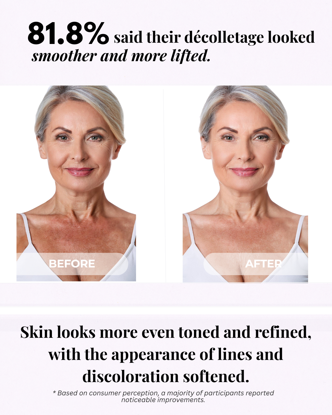 So Vein Diminishing Serum
